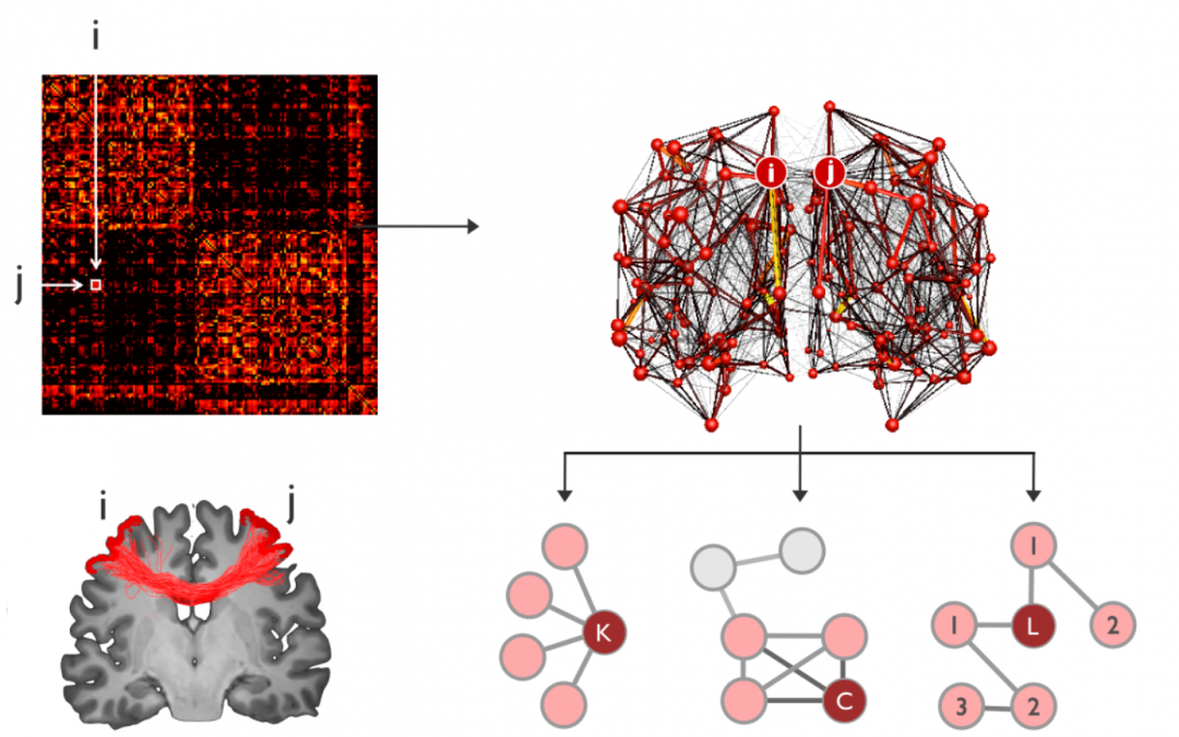 Multidimensional associations between cognition and connectome organization in temporal lobe epilepsy.